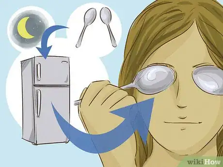 Image titled Get Rid of Black Circles Under Your Eyes Step 12