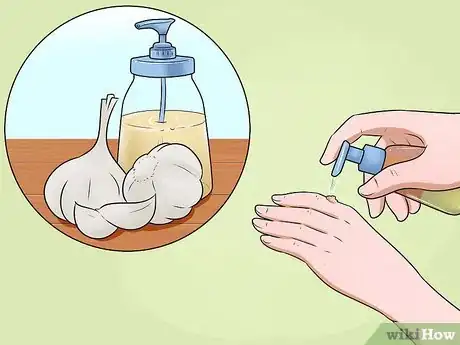 Image titled Get Rid of Warts on Hands Step 7