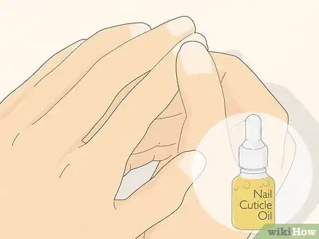 Image titled Get Rid of Hangnails Step 5