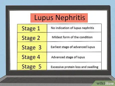 Image titled Treat Swollen Ankles and Feet for Lupus Nephritis Step 14