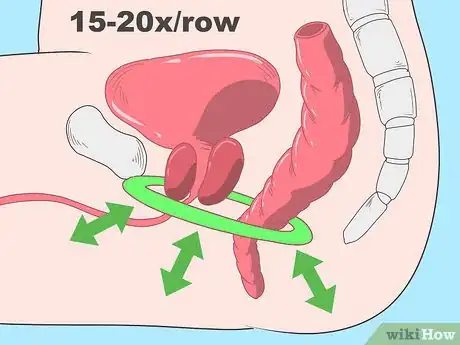 Image titled Stop Urine Leakage when Coughing Step 3