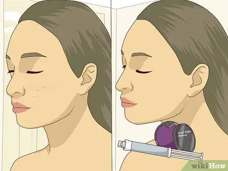 Image titled Get Rid of Dark Spots on Your Face Step 11