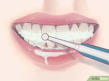 Image titled Treat Gum Disease With Home Made Remedies Step 9