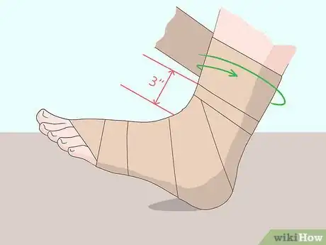 Image titled Wrap an Ankle with an ACE Bandage Step 6