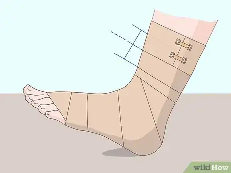 Image titled Wrap an Ankle with an ACE Bandage Step 7