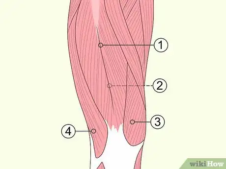 Image titled Treat Quad Strain Step 1