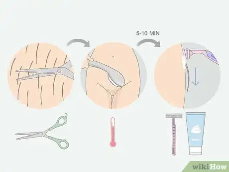 Image titled Get Rid of Ingrown Pubic Hair Step 14