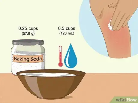 Image titled Prevent Ingrown Hairs After Waxing Using Home Remedies Step 8