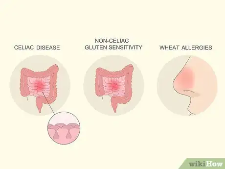 Image titled Test for Gluten Intolerance Step 2