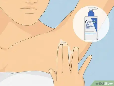 Image titled Heal Armpit Rash Step 18