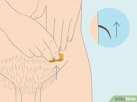 Image titled Do a Male Brazilian Wax Step 5