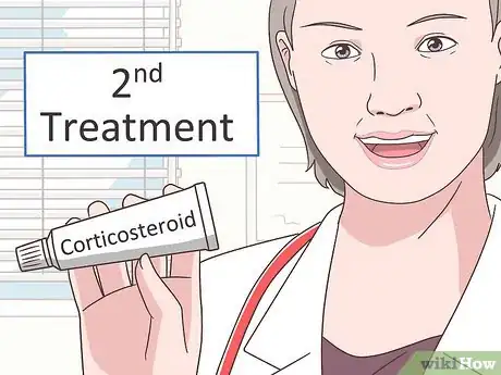 Image titled Treat Melasma Step 5