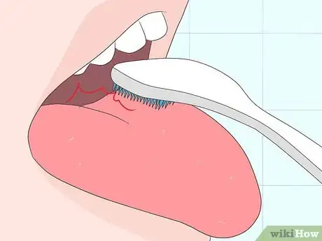 Image titled Use a Tongue Scraper Step 8