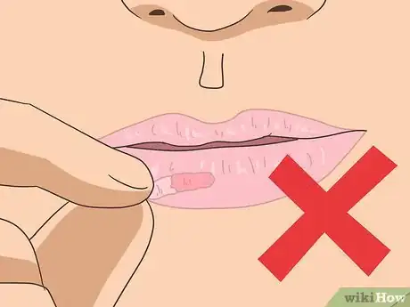 Image titled Stop Peeling Lips Step 12