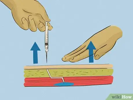 Image titled Give an Intramuscular Injection Step 18