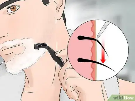 Image titled Stop Itching After Shaving Step 15