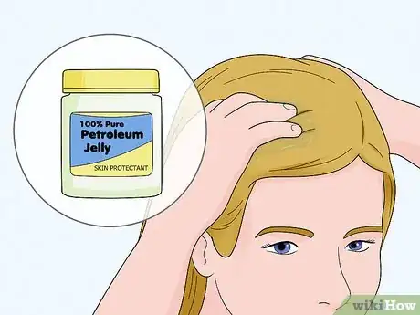 Image titled Get Rid of Head Lice Naturally Step 2