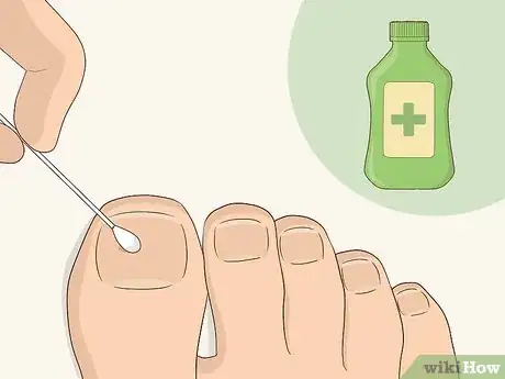 Image titled Give Yourself a Pedicure Using Salon Techniques Step 14