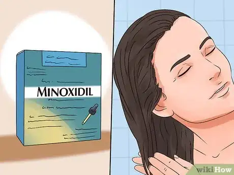 Image titled Stop Rapid Hair Loss Step 1