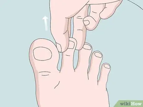 Image titled Crack Your Toe Step 5