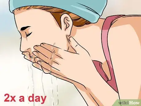 Image titled Remove a Blackhead from Your Forehead Step 7