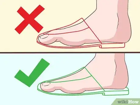 Image titled Style Mules Step 1