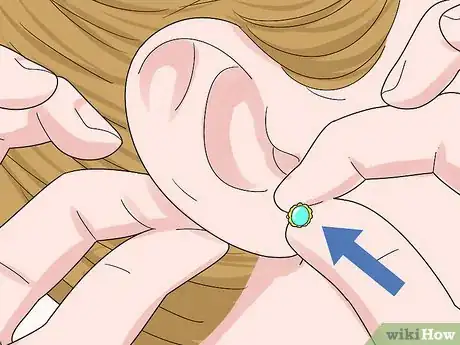 Image titled Remove Earrings for the First Time Step 6