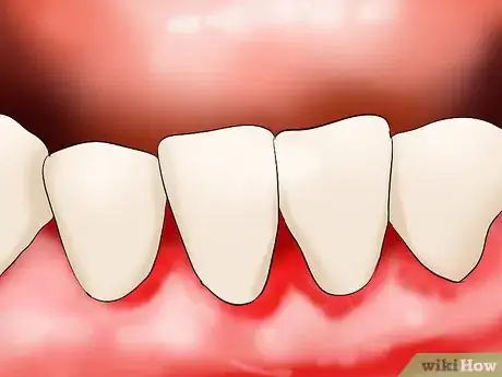 Image titled Care for Your Teeth As a Senior Citizen Step 7