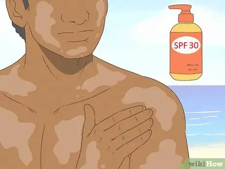 Image titled Protect Your Skin Step 8