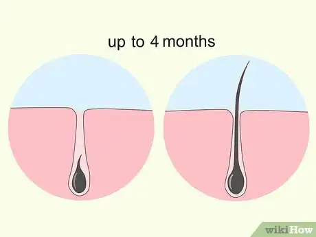 Image titled Use Minoxidil (Rogaine) Step 11