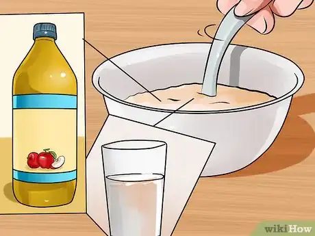 Image titled Cure Vaginal Infections Without Using Medications Step 16