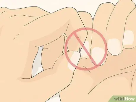 Image titled Get Rid of Hangnails Step 7