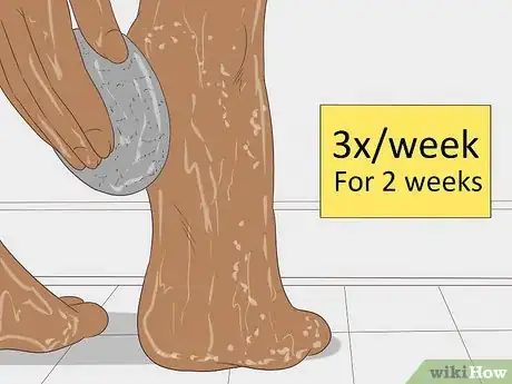 Image titled Remove Dry Skin from Your Feet Using Epsom Salt Step 19