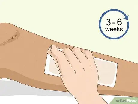 Image titled Prevent Ingrown Hairs After Waxing Using Home Remedies Step 11