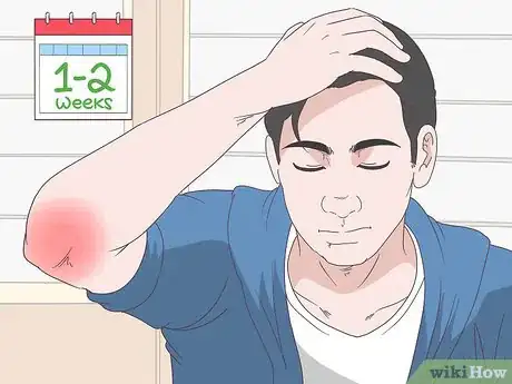 Image titled Treat Elbow Bursitis Step 11