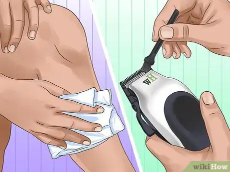 Image titled Trim Leg Hair Using a Trimmer Step 11