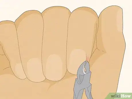 Image titled Get Rid of Hangnails Step 2