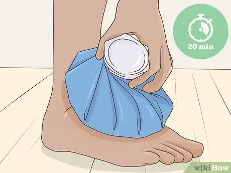 Image titled Reduce Edema Naturally Step 5