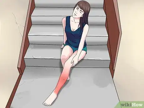 Image titled Recognize Cellulitis Symptoms Step 9