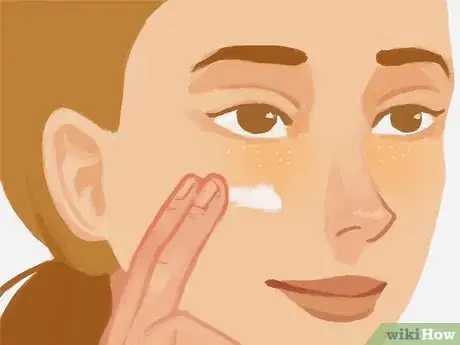 Image titled Remove Under Eye Milia Step 13