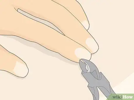 Image titled Get Rid of Hangnails Step 6