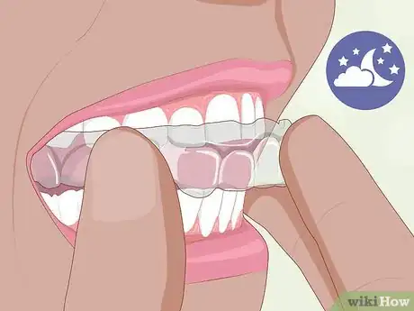 Image titled Prevent TMJ Step 9