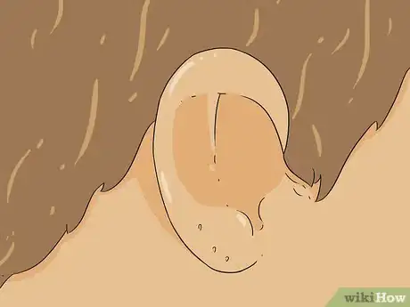 Image titled Re‐Pierce Ears Step 15