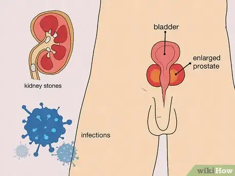 Image titled Deal with Testicular Pain Step 9