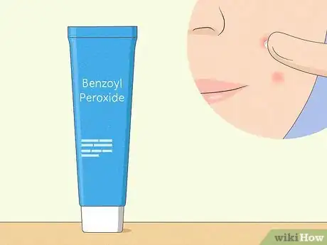 Image titled Reduce the Swelling and Redness of Pimples Step 9