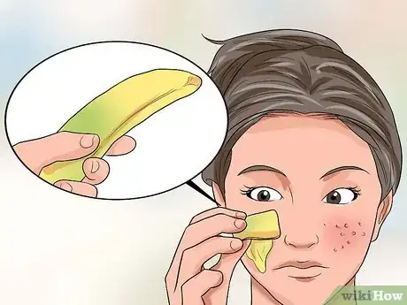 Image titled Get Rid of Large Pores and Blemishes Step 11