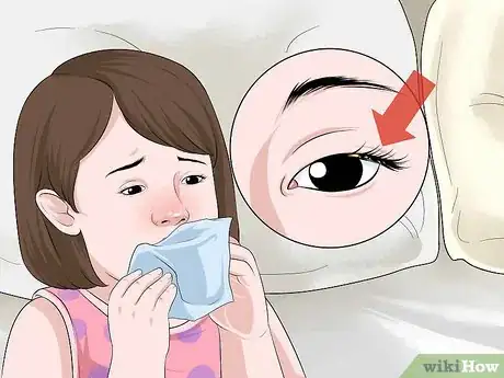 Image titled Clean a Toddler's Eyes Step 13