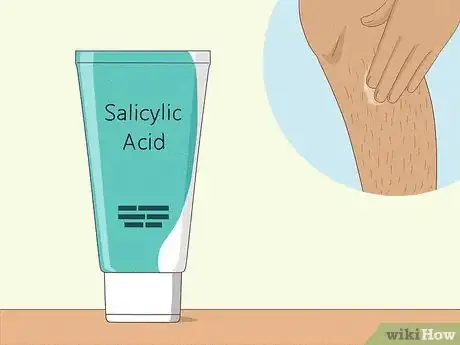 Image titled Prevent Ingrown Hairs After Waxing Using Home Remedies Step 4