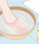 Remove Splinters from Feet