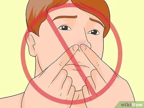 Image titled Prevent Blackheads Step 9